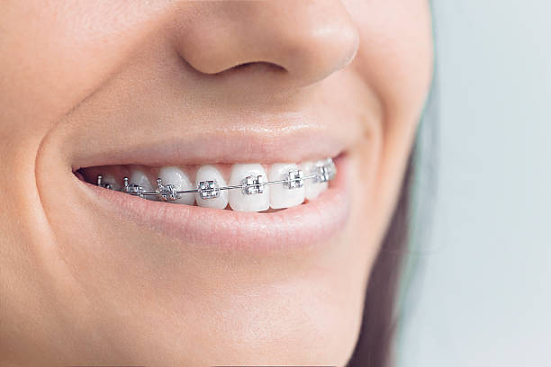 Best Traditional Braces  in Fort Belknap Agency, MT